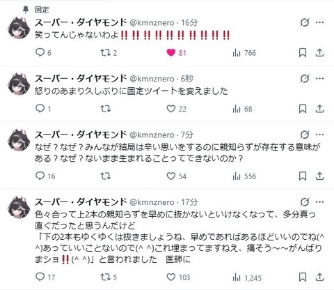 【KMNZ】ネロ「下の親知らず2本とも完全に横向きで埋まっていて…」← 一番アカンタイプのやつやん | 【KMNZ】ネロ「下の親知らず2本とも完全に横向きで埋まっていて…」← 一番アカンタイプのやつやん | VTuberまとめ速報 V速(画像11180916151920_2) 【KMNZ】ネロ「下の親知らず2本とも完全に横向きで埋まっていて…」← 一番アカンタイプのやつやん | 【KMNZ】ネロ「下の親知らず2本とも完全に横向きで埋まっていて…」← 一番アカンタイプのやつやん | VTuberまとめ速報 V速(画像11180916151920_2)